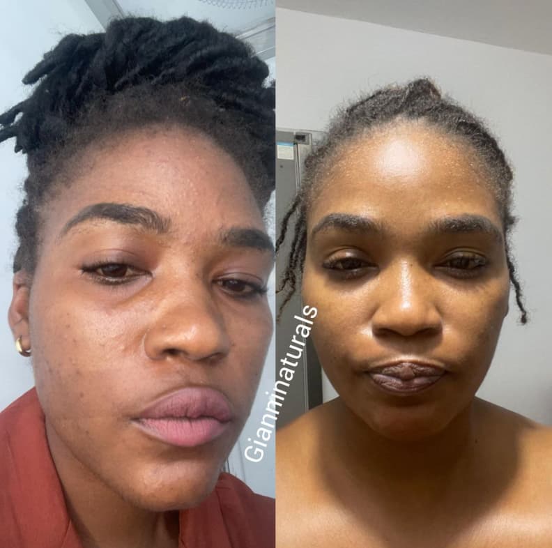 Client skincare transformation